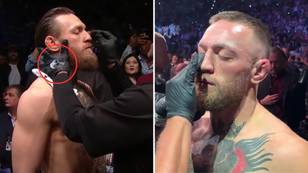 Why UFC fighters put vaseline on their face before a fight